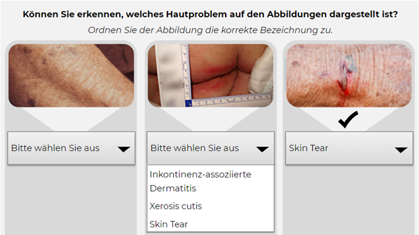 Auf diesem interaktiven Ausschnitt aus dem E-Learning-Kurs zum Expertenstandard zur Erhaltung und Förderung der Hautintegrität sehen Sie die Darstellung von drei verschiedenen Hautproblemen. 